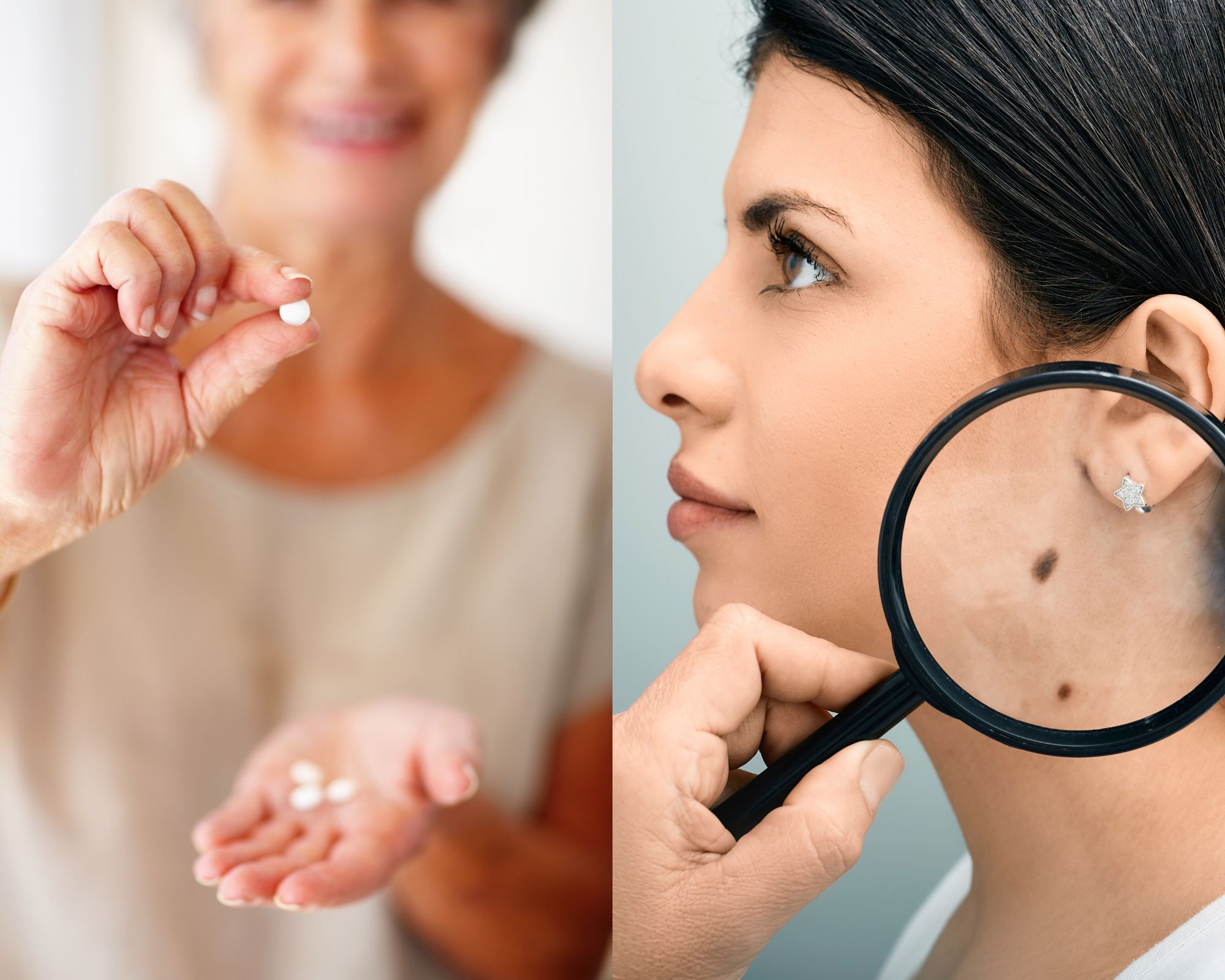 نوعی قرص فشار خون می‌تواند خطر ابتلا به سرطان پوست را افزایش دهد