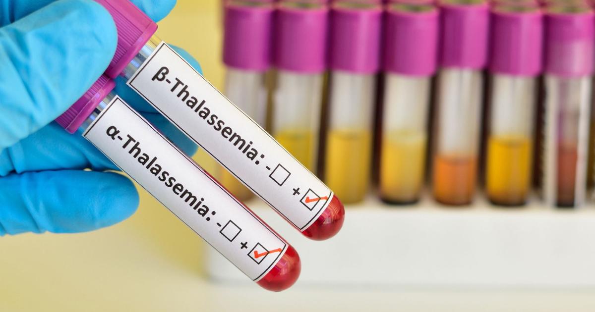 تالاسمی چیست و آیا درمان‌های بهتری در راه است؟ | ایندیپندنت فارسی